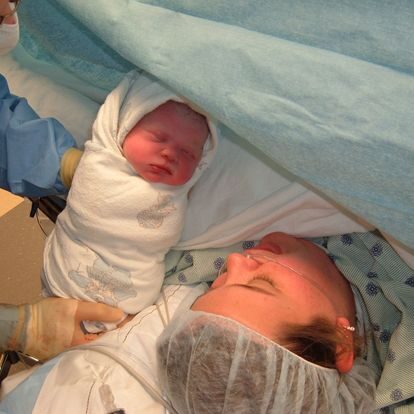 Baby born via cesarean swaddled with hood